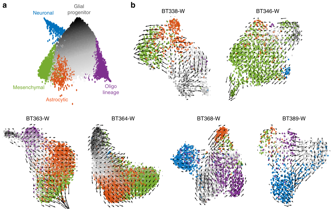 膠質(zhì)母細(xì)胞瘤RNA速度分析